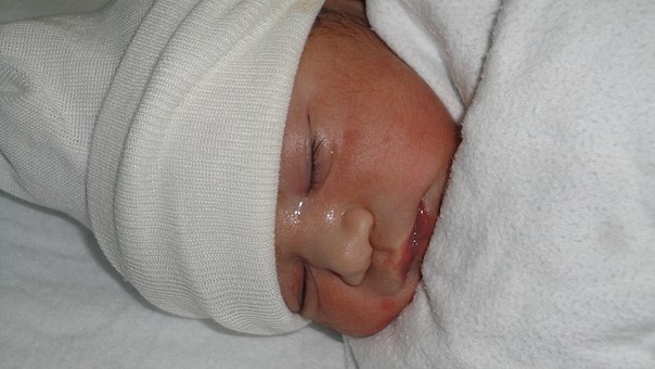 Possible Dermatologist Concerns For Babies