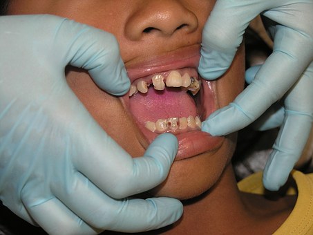 Dentists - Advice From Them Will Save Your Smile