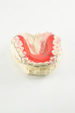 Dental Implants Costs - Get Teeth In 3 Days With Dental Implants
