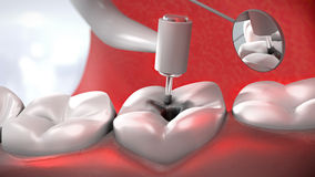 Comparing Dentists In Toronto To End Up With Excellent Dental Care