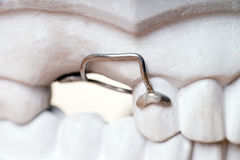 Office Teeth Whitening With Your Dentist