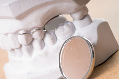 How to Take Care of your Teeth with Teeth Whitening Kits