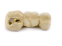 Effective Teeth Whitening - Finding A Teeth Whitening Solution That Works