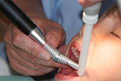 Teeth Whitening - Get the Sparkling Look You Always Desired