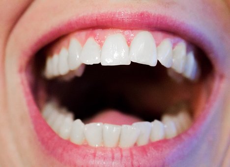 Restorative Dentistry In South Kensington