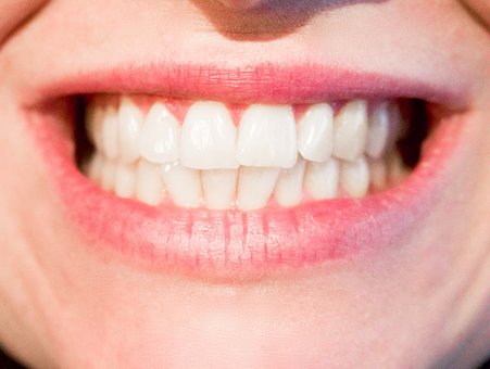 Dental Implants: Solution For Missing Teeth