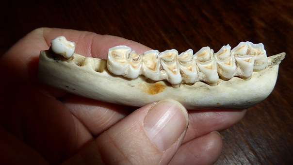 Affordable Dental Implants In India