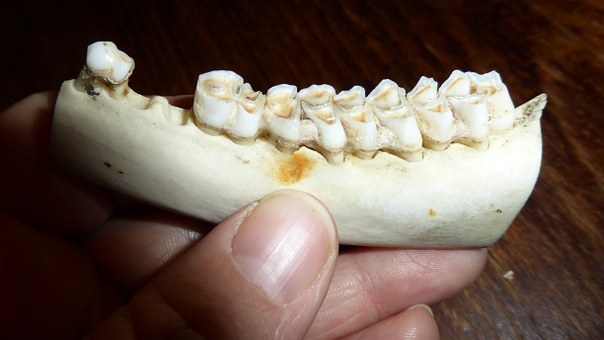 Personal Dental Care: Taking Care Of Your Teeth