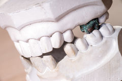 Cosmetic Dentistry Can Improve The Appearance Of Your Teeth