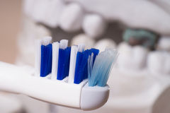 Are Dental Implants Worth the Time, Money and Trouble? Put Simply, Yes!