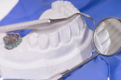 Different Types Of Sedation Dentistry