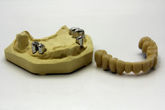 All About Discount Dental Coverage Plans