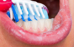 Best Hollis Ny Dentist