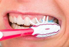 Dentist Keswick Teeth Whitening - The Key Reason Why Specialized Whitening Is Better
