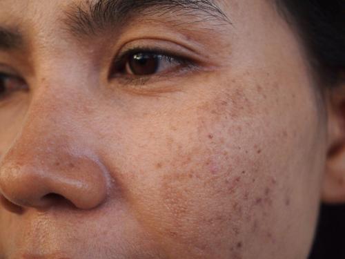 點擊在新窗口查看全圖