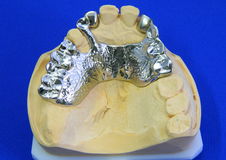 Cosmetic Teeth Whitening Treatment
